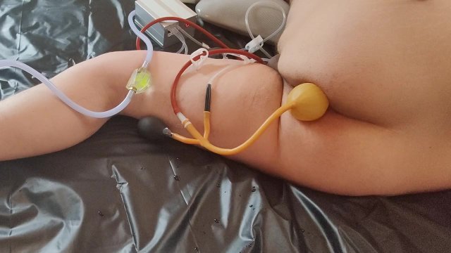 Huge belly inflation using..